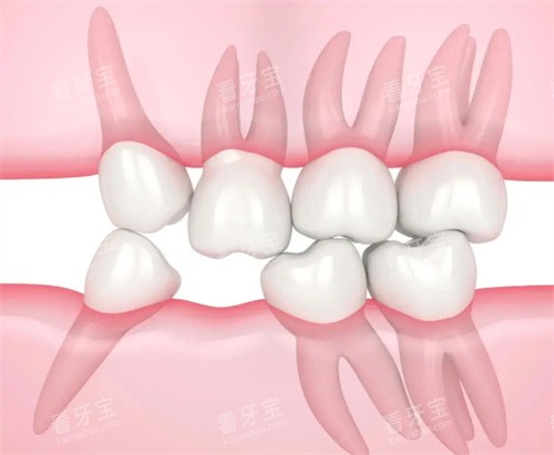 ���ݰ�������ͼƬ