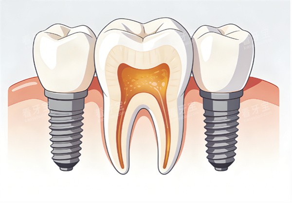 ��ֲ���ݿ�ͨʾ��ͼ