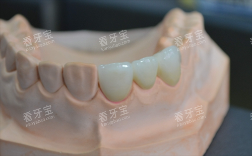 ��װ������ģ���ϵ�ȫ������Ч