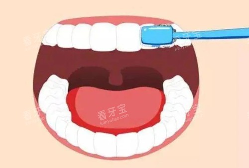 宜宾同步齿科洗牙 + 补牙全记录:服务贴心,再也不拖延看牙了