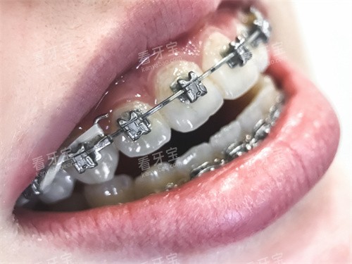 ������������ͼƬ