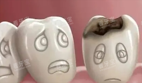 烂牙齿动画展示 烂牙齿动画展示