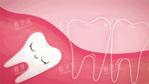 智齿卡通图片展示 智齿卡通图片展示