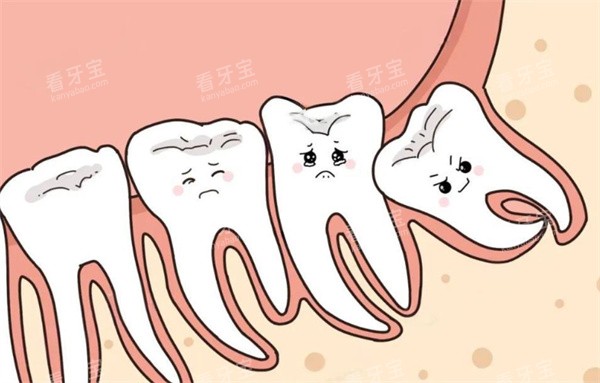 智齿治疗卡通图 智齿治疗卡通图
