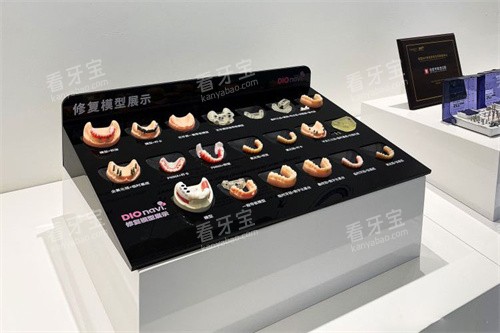 郑州白皮书口腔医院修复模型展示 郑州白皮书口腔医院修复模型展示