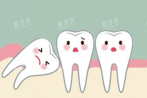 智齿图片一览 智齿图片一览