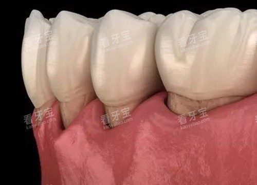 ����ή����ͨʾ��ͼ