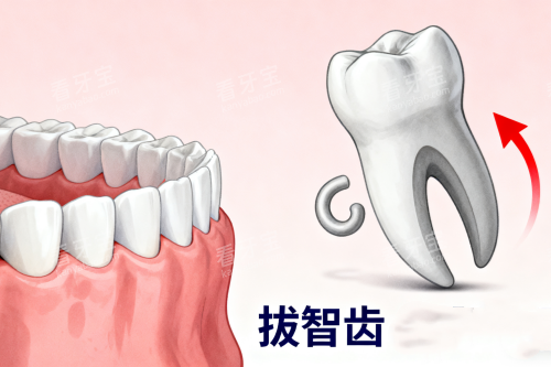 拔智齿卡通一览图 拔智齿卡通一览图