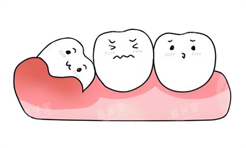 智齿卡通图片 智齿卡通图片
