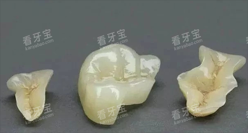 牙齿修复材料图 牙齿修复材料图