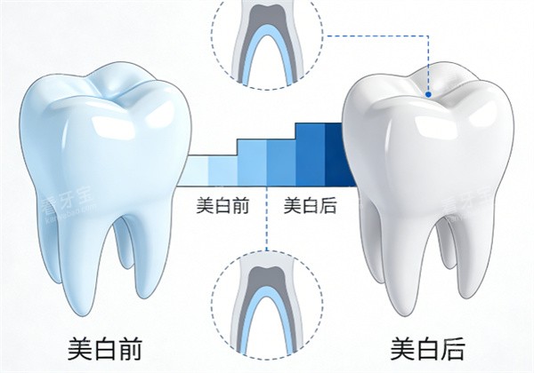 牙齿美白前后示意图 牙齿美白前后示意图
