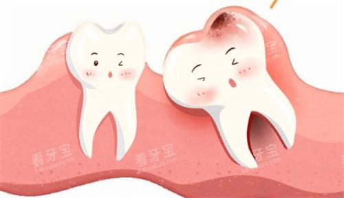 拔智齿.jpg 拔智齿.jpg