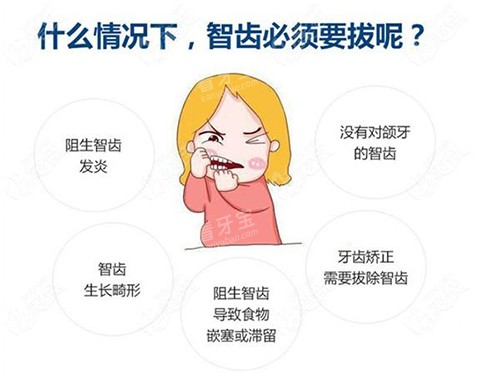 拔智齿的不同情况.jpg 拔智齿的不同情况.jpg