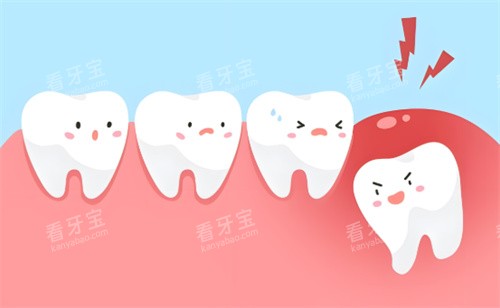 拔智齿动画.jpg 拔智齿动画.jpg