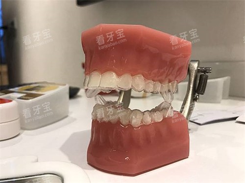 隐形牙齿矫正牙套模型.jpg 隐形牙齿矫正牙套模型.jpg