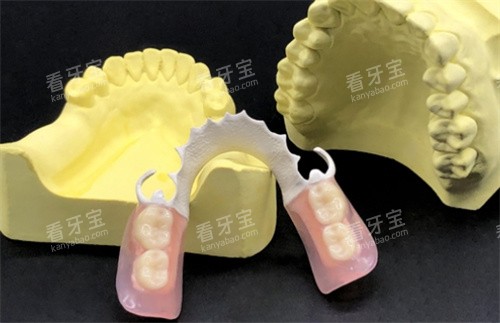 hpp粘接桥实物.jpg hpp粘接桥实物.jpg