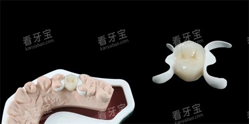 hpp粘接桥义齿实物展示图.jpg hpp粘接桥义齿实物展示图.jpg
