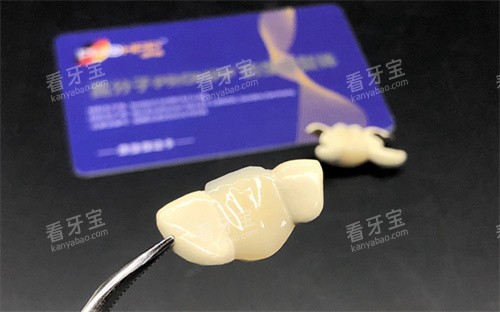 PROHPP聚合瓷粘接桥.jpg PROHPP聚合瓷粘接桥.jpg