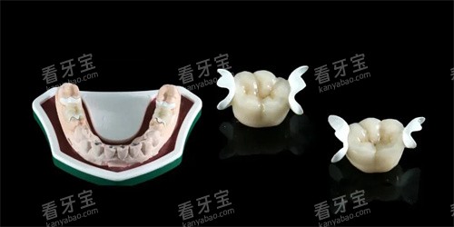 hpp粘接桥义齿模型展示图.jpg hpp粘接桥义齿模型展示图.jpg
