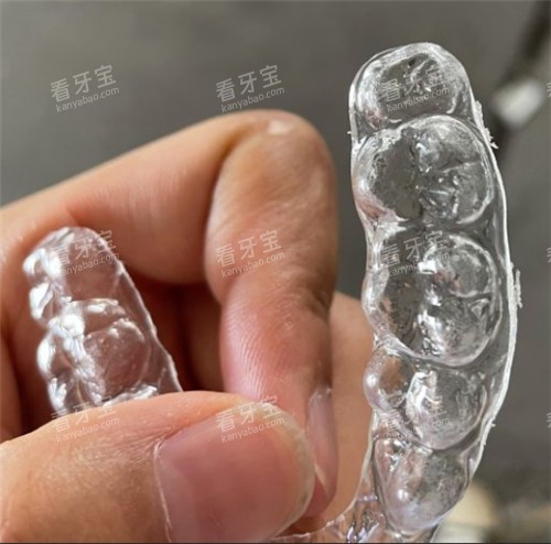 正雅隐形牙套.jpg 正雅隐形牙套.jpg