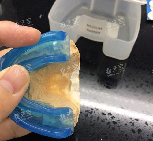 牙齿矫正MRC早期肌功能矫正器石膏模型试戴.jpg 牙齿矫正MRC早期肌功能矫正器石膏模型试戴.jpg