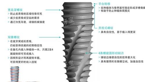 韩国柯威尔种植牙介绍.jpg 韩国柯威尔种植牙介绍.jpg