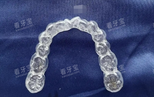 时代天使隐形矫正器.png 时代天使隐形矫正器.png