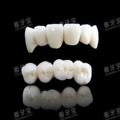 全瓷牙冠修复展示.jpg 全瓷牙冠修复展示.jpg