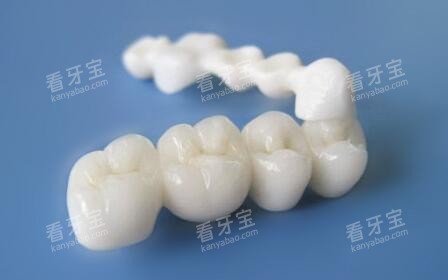 全瓷牙冠修复材料展示图.jpg 全瓷牙冠修复材料展示图.jpg