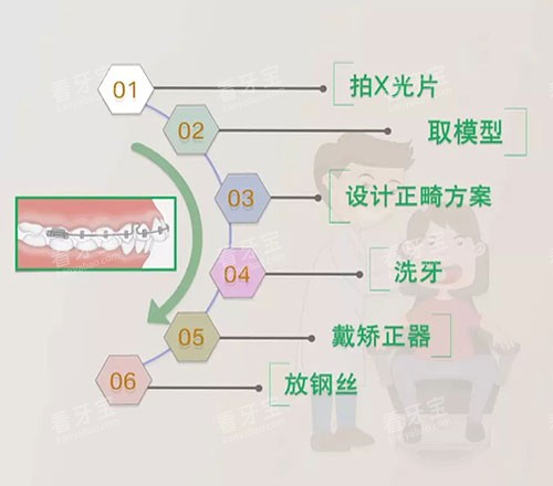 牙齿矫正流程.jpg 牙齿矫正流程.jpg