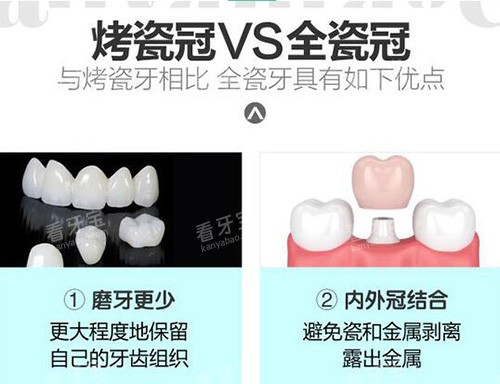 烤瓷冠全瓷冠优势对比.jpg 烤瓷冠全瓷冠优势对比.jpg