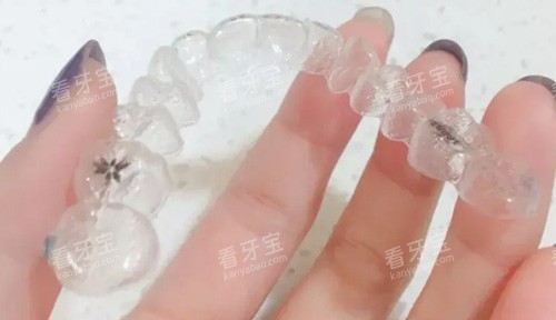时代天使牙套照片.jpg 时代天使牙套照片.jpg