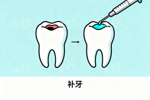 补牙修复展示图.png 补牙修复展示图.png