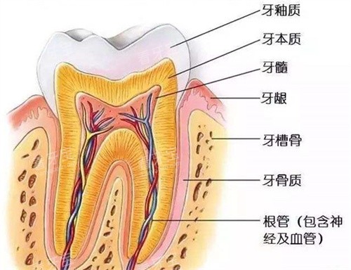 根管治疗剖析图.jpg 根管治疗剖析图.jpg