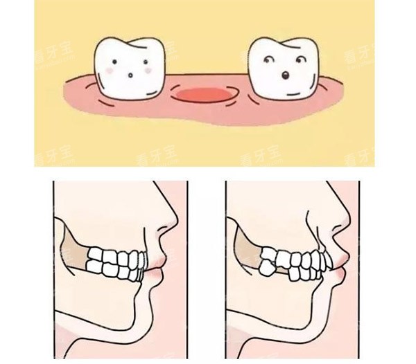 缺牙照片.jpg 缺牙照片.jpg
