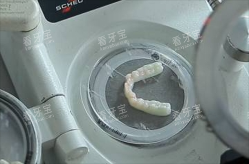 隐形矫正制模过程.png 隐形矫正制模过程.png