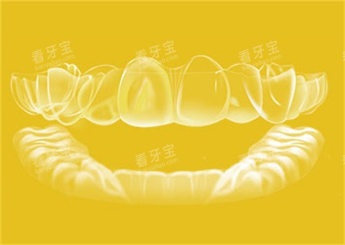 丽绮美隐形矫正器.jpg 丽绮美隐形矫正器.jpg