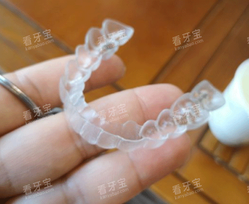 隐形牙齿矫正牙套图.png 隐形牙齿矫正牙套图.png