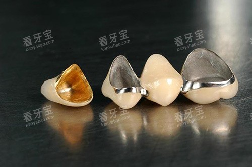 全瓷牙冠材料展示.jpg 全瓷牙冠材料展示.jpg