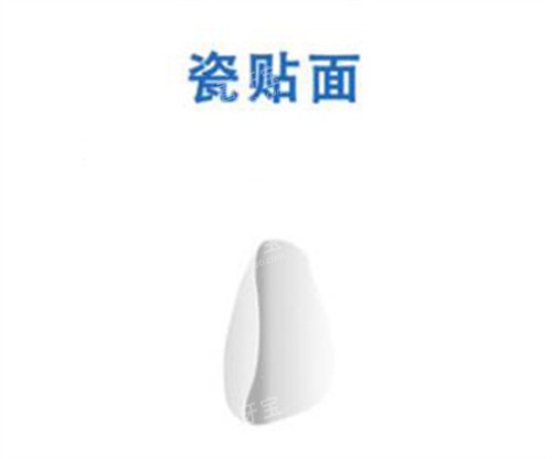 瓷贴面修复改善图.jpg 瓷贴面修复改善图.jpg