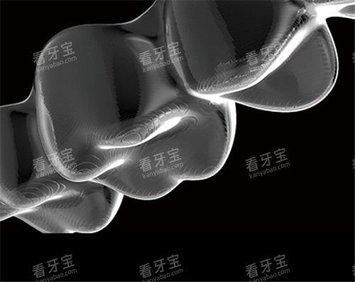 美立刻隐形矫治器图片.jpg 美立刻隐形矫治器图片.jpg