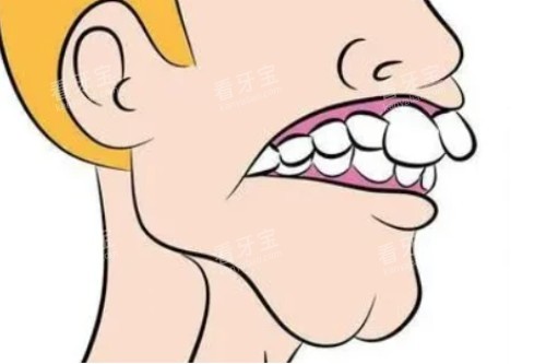 龅牙卡通图片展示.jpg 龅牙卡通图片展示.jpg