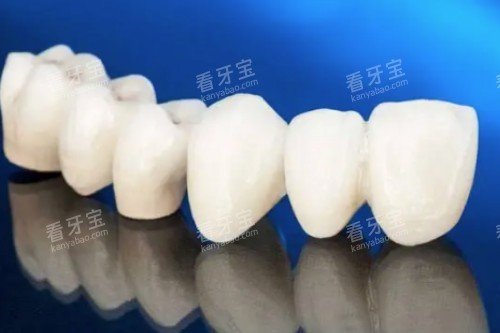 爱尔创全瓷牙模型图.jpg 爱尔创全瓷牙模型图.jpg
