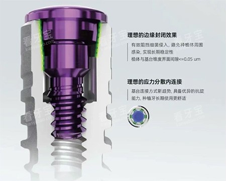 卡尔斯种植牙特色照片.jpg 卡尔斯种植牙特色照片.jpg