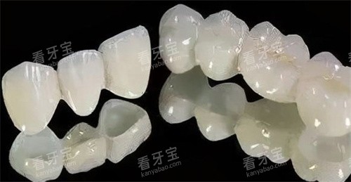 二氧化锆全瓷牙.jpg 二氧化锆全瓷牙.jpg