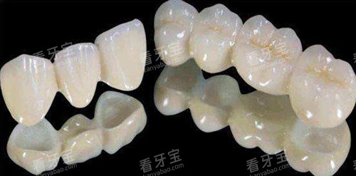 全瓷牙冠示意图.jpg 全瓷牙冠示意图.jpg