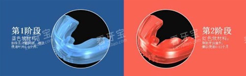 罗慕矫治器不同阶段图示.jpg 罗慕矫治器不同阶段图示.jpg