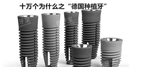 德国种植牙示意图.jpg 德国种植牙示意图.jpg