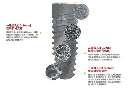 卡尔斯种植牙表面技术.jpg 卡尔斯种植牙表面技术.jpg
