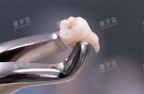 拔掉的牙齿照片.jpg 拔掉的牙齿照片.jpg